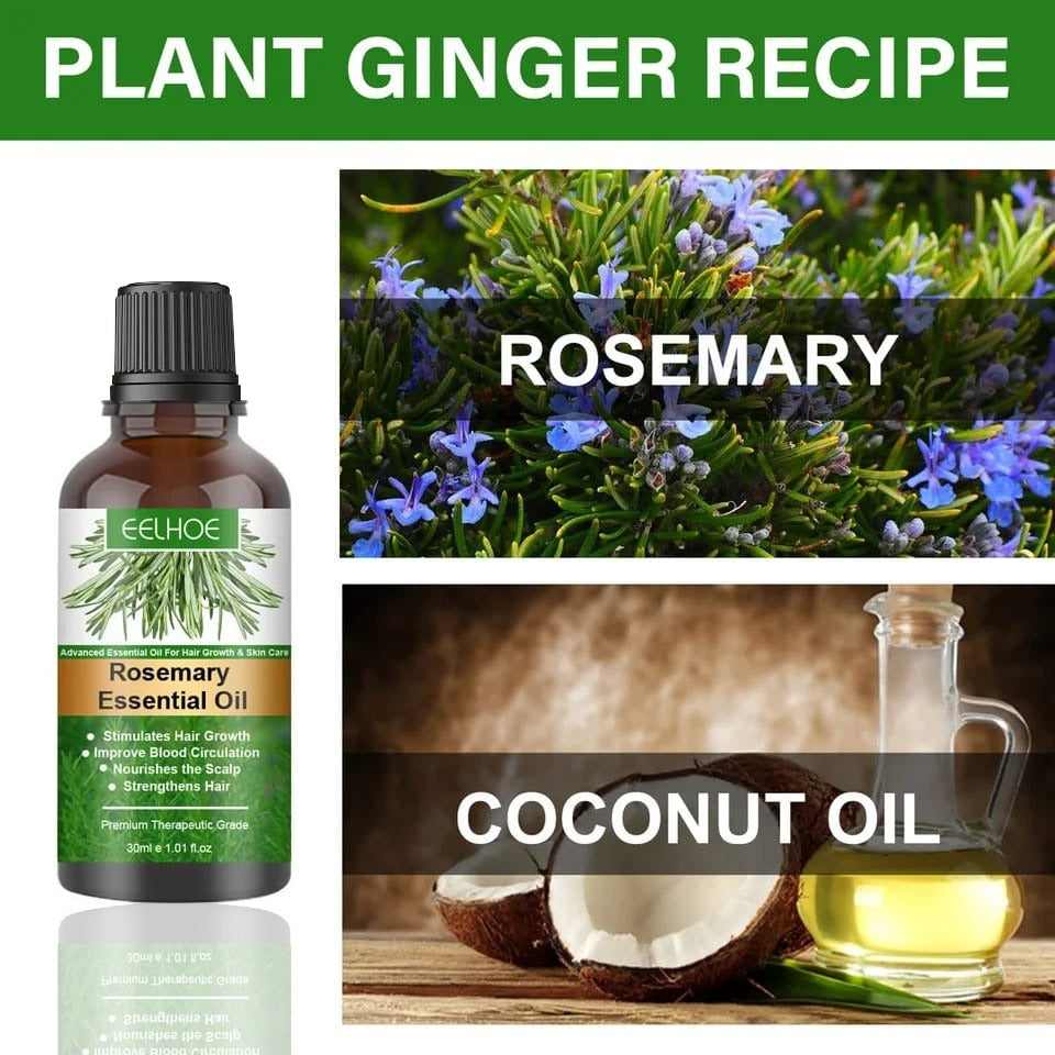30ml Rosemary Hair Growth Essential Oil Bottle